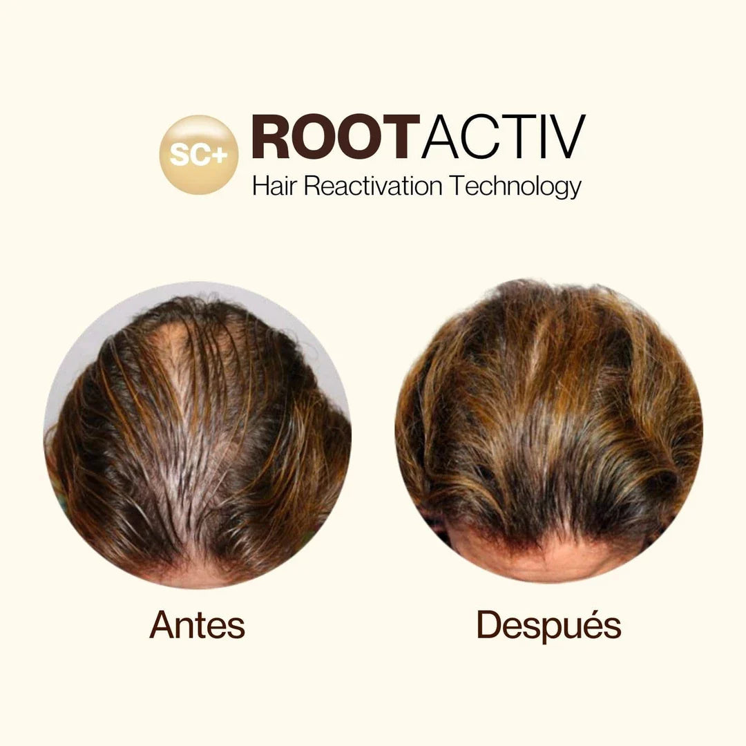 ROOTACTIVE X3 - - La bonne remise