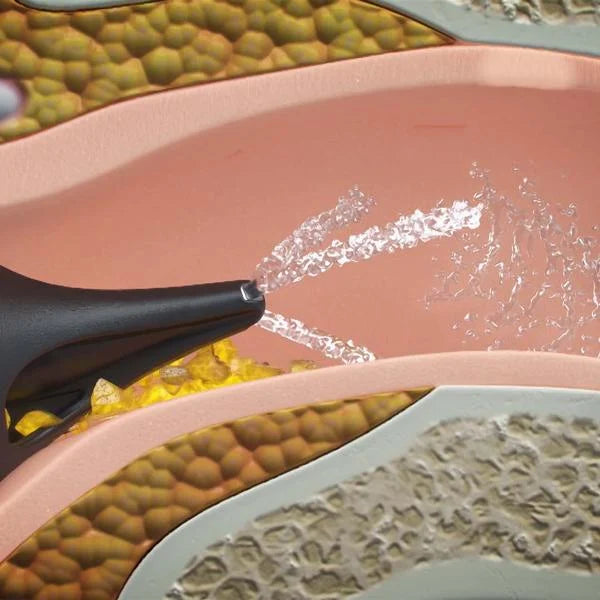 Wush - - La bonne remise