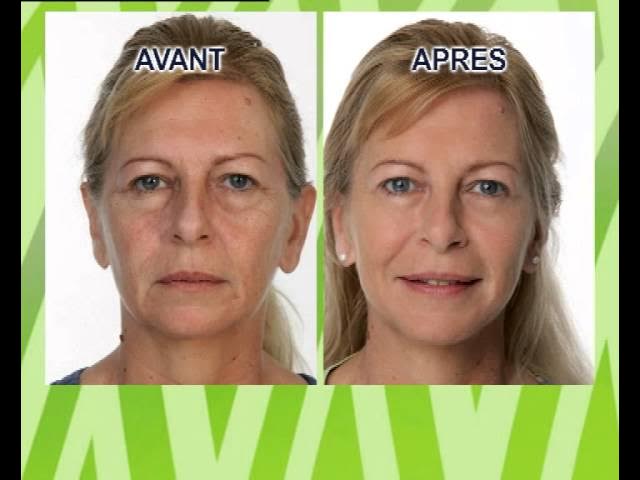 Jeunesse mysterieuse X2 -  - La bonne remise