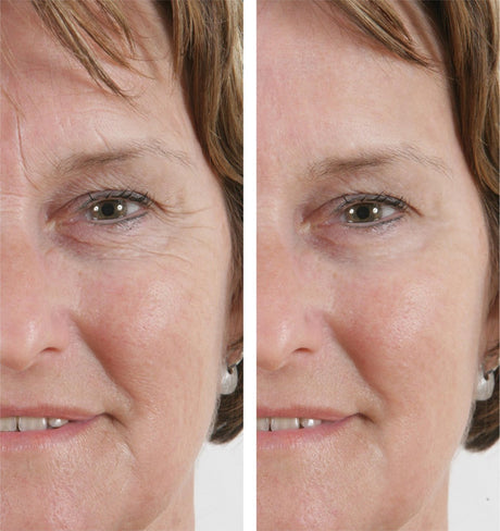 Power Tense - Wrinkle Power -  - La bonne remise