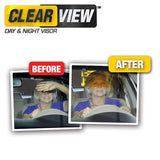 CLEAR VIEW X2 - Auto - La bonne remise