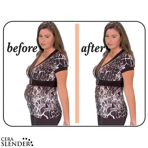 CERA SLENDER - Vêtement amincissent - La bonne remise