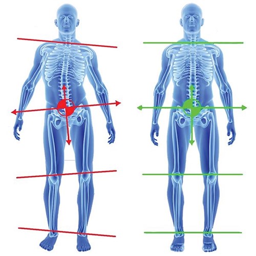 +SUPERTHOTICS - - La bonne remise