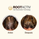 ROOTACTIVE X3 -  - La bonne remise