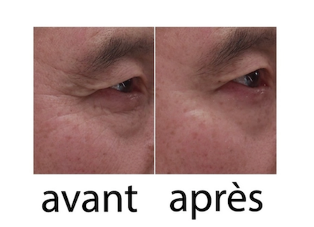 Power Tense - Wrinkle Power -  - La bonne remise