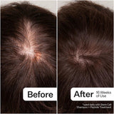 ROOT ACTIVE